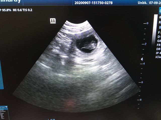 Ultraschall 2