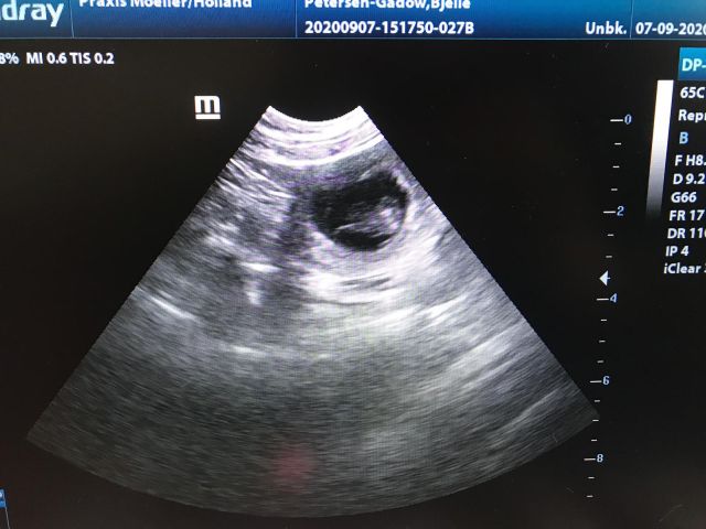 Ultraschall 3